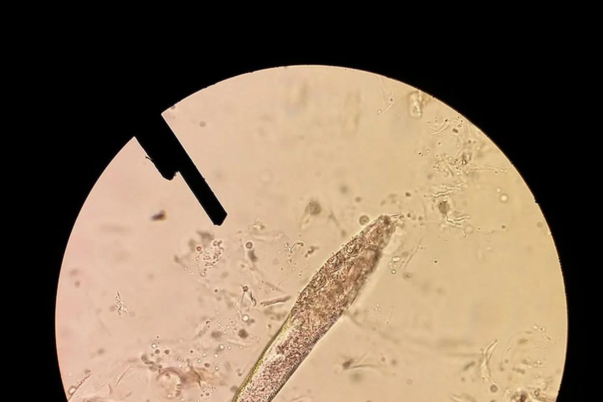 Close-up under a microscope showing a mite with a sampling probe nearby